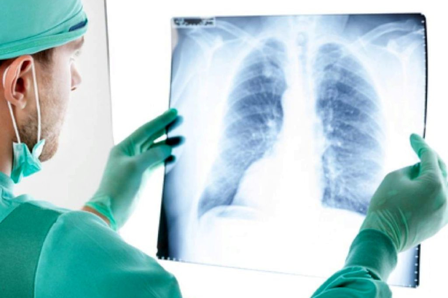 Фрагмент птичьего шейного позвонка извлекли у пациента из бронхов в Одинцово